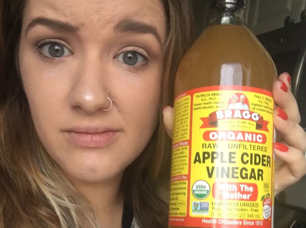 Ways to Use Apple Cider Vinegar for Your Face- Is It Safe to Use Apple Cider Vinegar on Skin